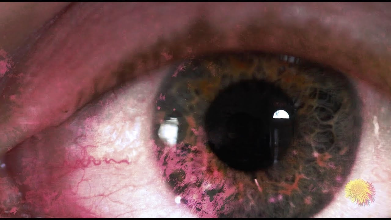 Foundation Fighting Blindness